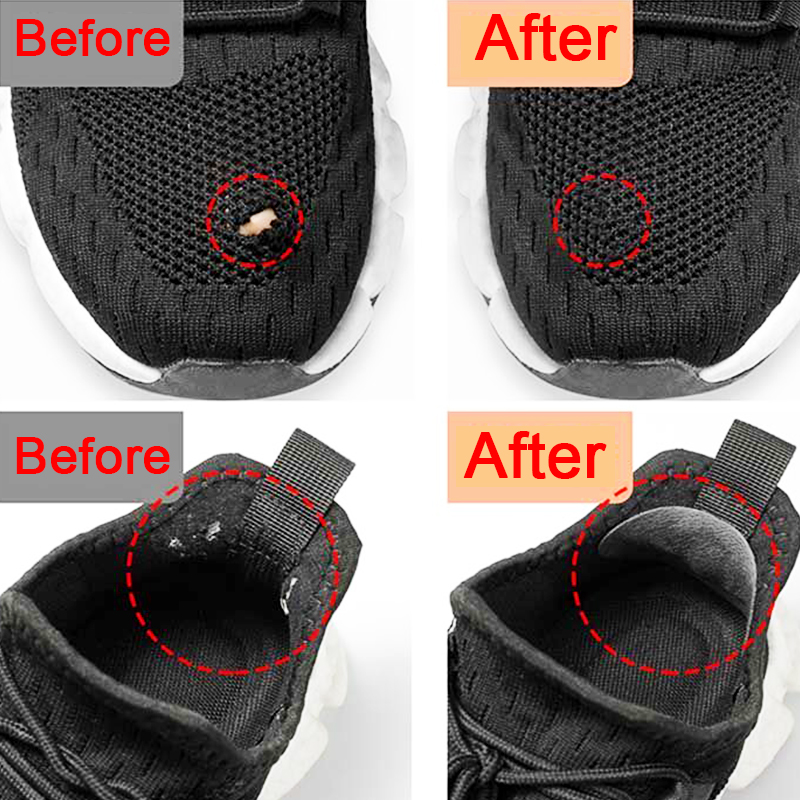 Sportschoenenpatches, reparati - Sneaker Care Kit recensie en prijs